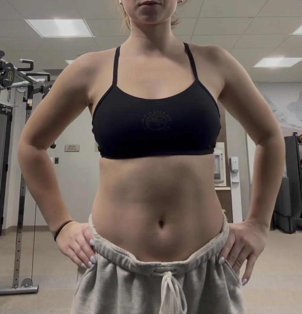 Before front-view fitness transformation photograph